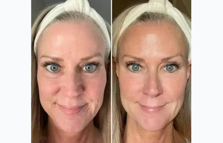 kollagen-intensiv-user