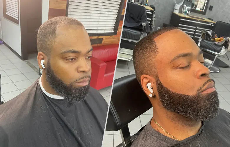Hair illusion-before-after