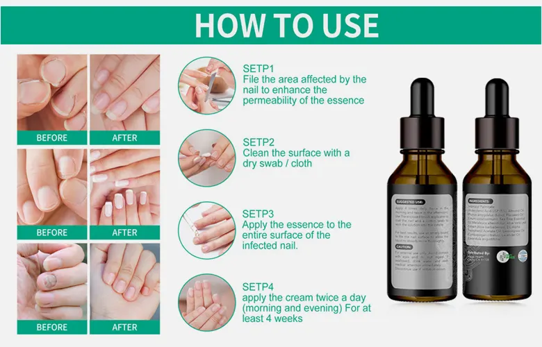 Metanail Serum Pro-review